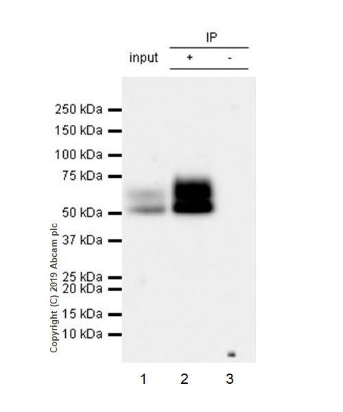 Immunoprecipitation - Anti-IL-13 receptor alpha 2 antibody [EPR22978-163] - BSA and Azide free (AB263874), expandable thumbnail