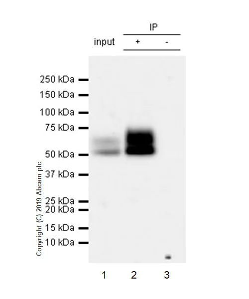 Immunoprecipitation - Anti-IL-13 receptor alpha 2 antibody [EPR22978-163] - BSA and Azide free (AB263874)