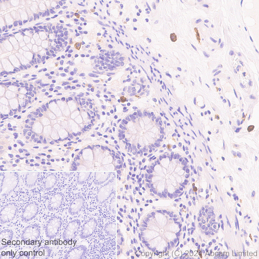 Immunohistochemistry (Formalin/PFA-fixed paraffin-embedded sections) - Anti-IL-13 receptor alpha 2 antibody [EPR29921-543] (AB322898), expandable thumbnail