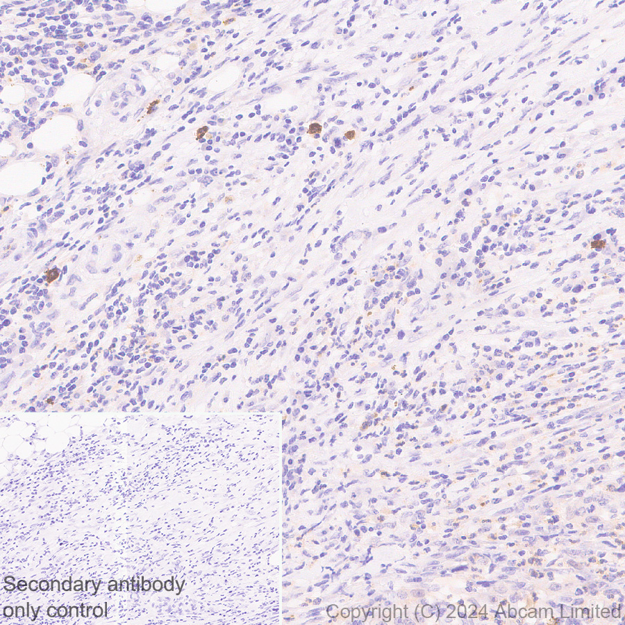 Immunohistochemistry (Formalin/PFA-fixed paraffin-embedded sections) - Anti-IL-13 receptor alpha 2 antibody [EPR29921-543] (AB322898), expandable thumbnail