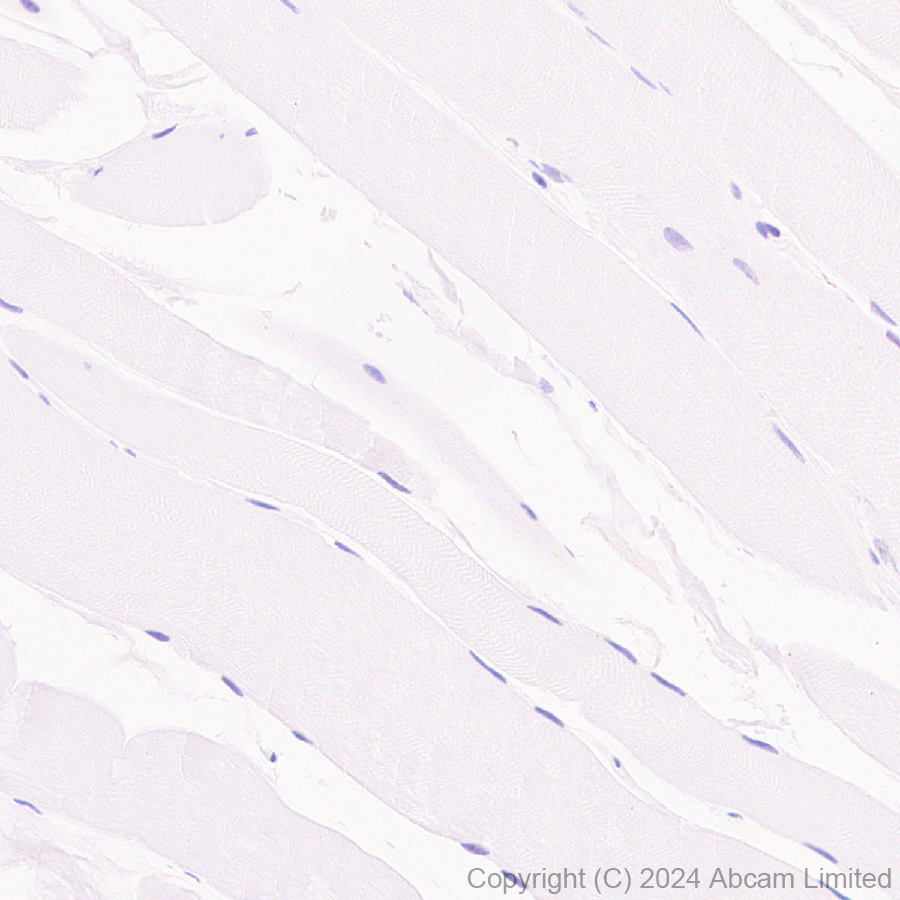 Immunohistochemistry (Formalin/PFA-fixed paraffin-embedded sections) - Anti-IL-13 receptor alpha 2 antibody [EPR29921-543] (AB322898), expandable thumbnail