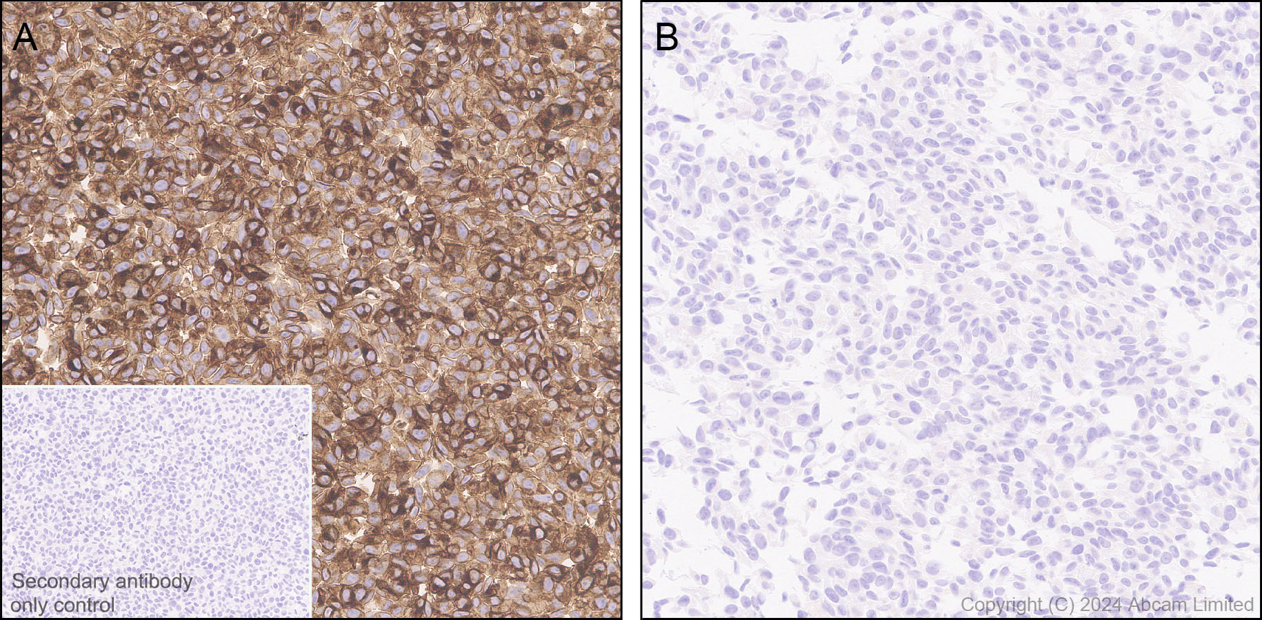 Immunohistochemistry (Formalin/PFA-fixed paraffin-embedded sections) - Anti-IL-13 receptor alpha 2 antibody [EPR29921-543] (AB322898), expandable thumbnail