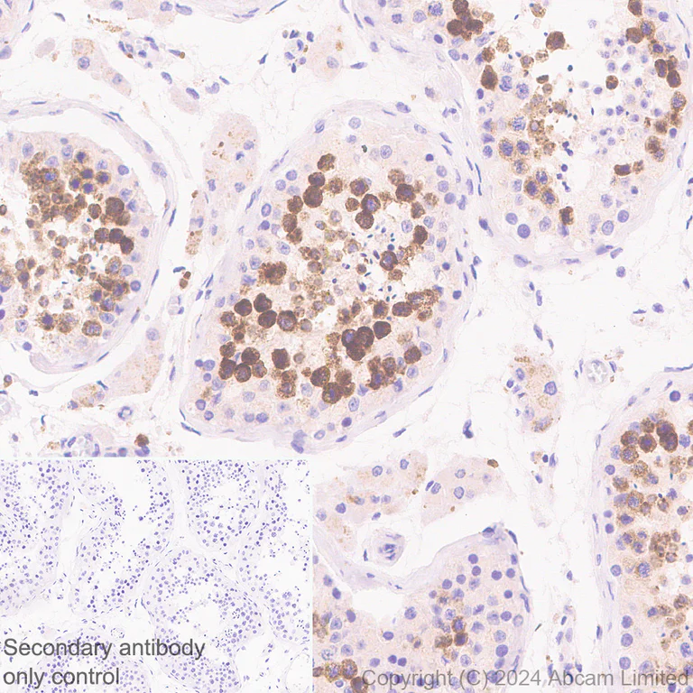 Immunohistochemistry (Formalin/PFA-fixed paraffin-embedded sections) - Anti-IL-13 receptor alpha 2 antibody [EPR29921-543] - BSA and Azide free (AB325959)