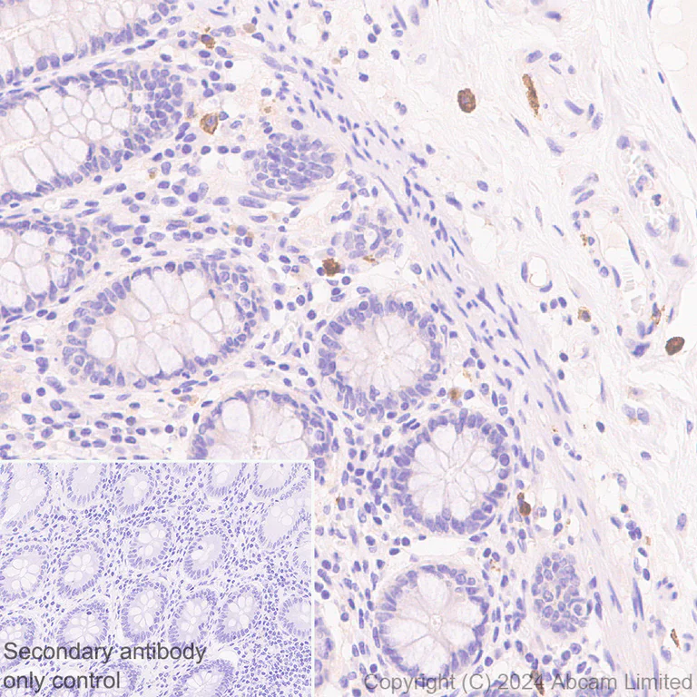 Immunohistochemistry (Formalin/PFA-fixed paraffin-embedded sections) - Anti-IL-13 receptor alpha 2 antibody [EPR29921-543] - BSA and Azide free (AB325959)