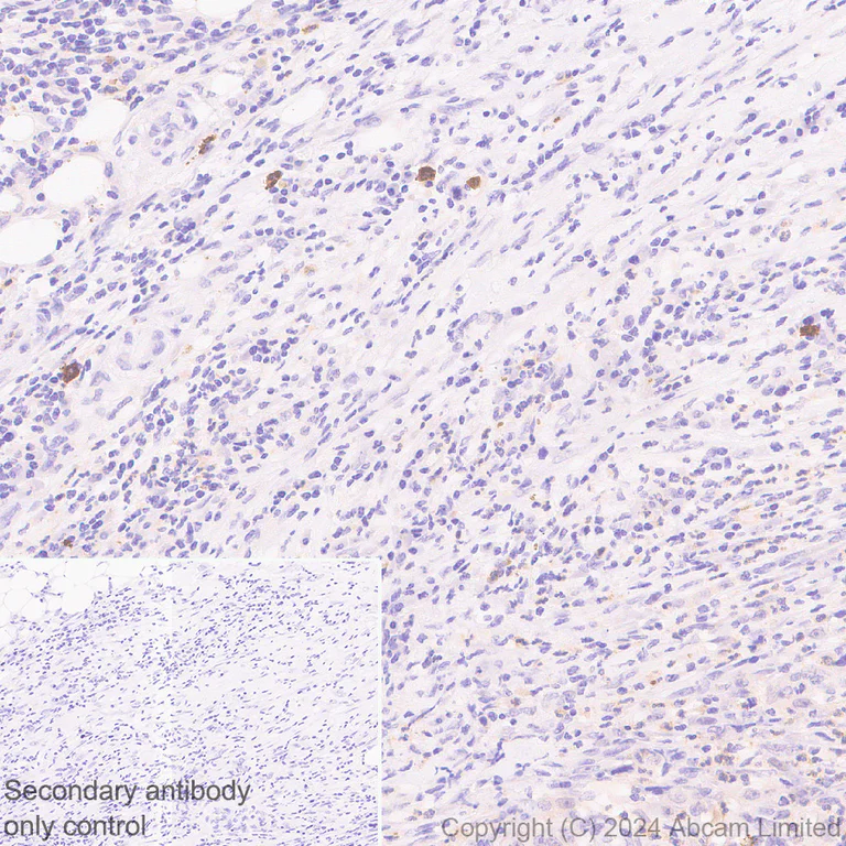 Immunohistochemistry (Formalin/PFA-fixed paraffin-embedded sections) - Anti-IL-13 receptor alpha 2 antibody [EPR29921-543] - BSA and Azide free (AB325959)
