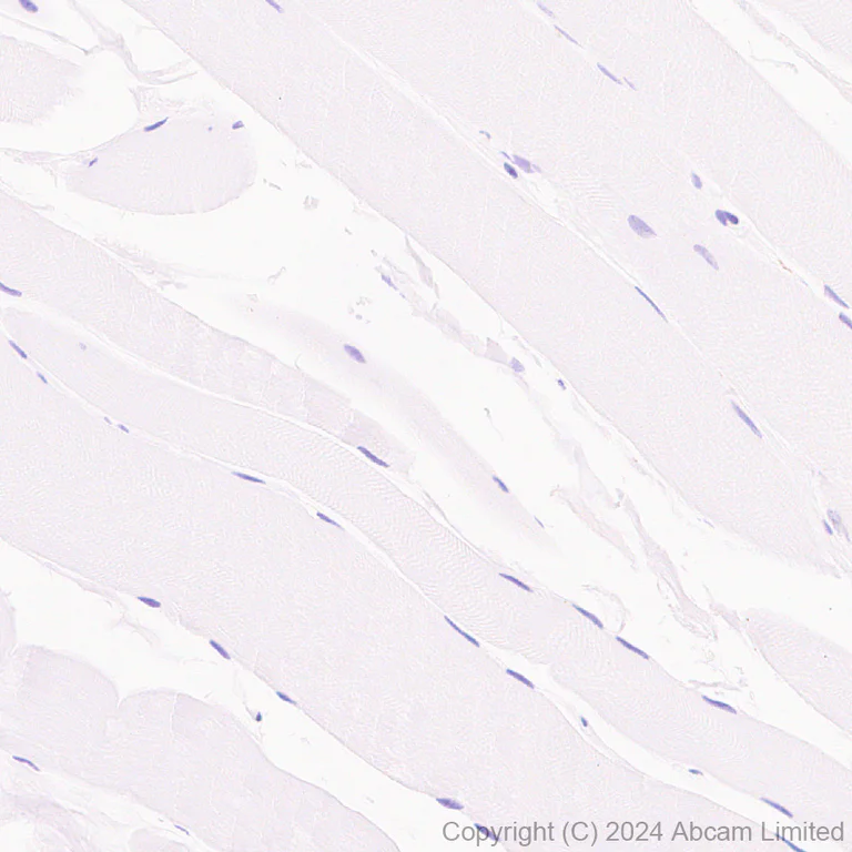 Immunohistochemistry (Formalin/PFA-fixed paraffin-embedded sections) - Anti-IL-13 receptor alpha 2 antibody [EPR29921-543] - BSA and Azide free (AB325959)