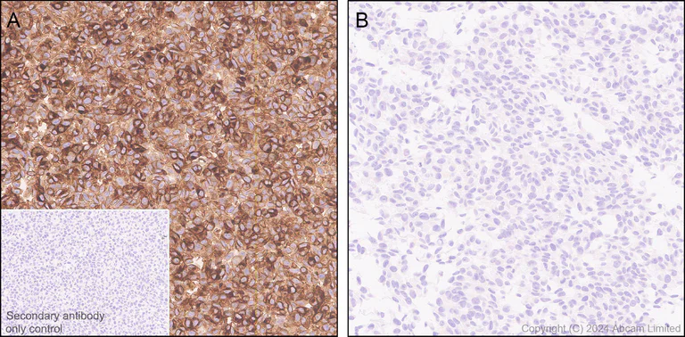 Immunohistochemistry (Formalin/PFA-fixed paraffin-embedded sections) - Anti-IL-13 receptor alpha 2 antibody [EPR29921-543] - BSA and Azide free (AB325959)