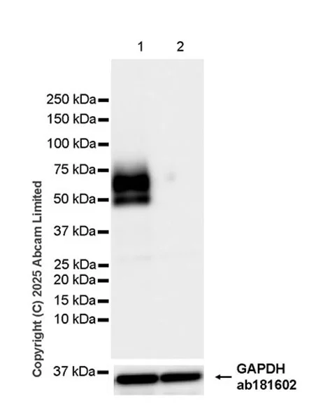 Western blot - Anti-IL-13 receptor alpha 2 antibody [EPR29921-543] - BSA and Azide free (AB325959)