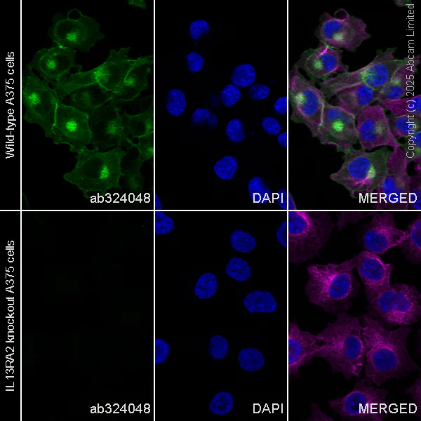 Immunocytochemistry/ Immunofluorescence - Anti-IL-13 receptor alpha 2 antibody [EPR29921-581] (AB324048)