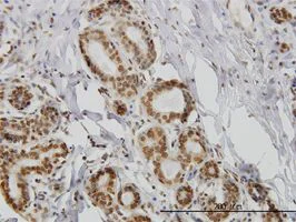 Immunohistochemistry (Formalin/PFA-fixed paraffin-embedded sections) - Anti-IL-15 antibody [3A3] (AB55276)