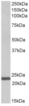 Western blot - Anti-IL-15 antibody (AB166923)