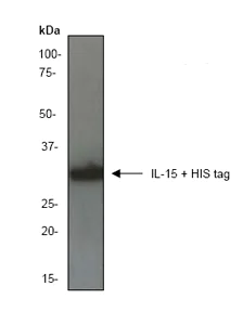 Western blot - Anti-IL-15 antibody [EP433Y] (AB40668)