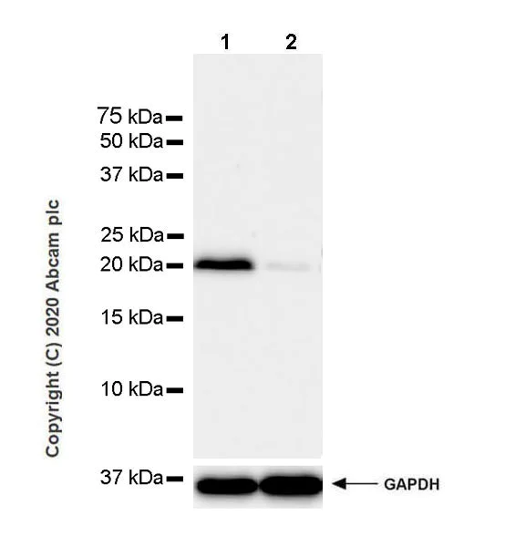 Western blot - Anti-IL-15 antibody [EPR22635-214] - BSA and Azide free (AB273631)
