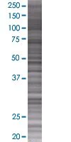 SDS-PAGE - IL-15 overexpression 293T lysate (whole cell) (AB94112)