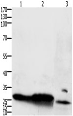 Western blot - Anti-IL-15RA antibody (AB183113)