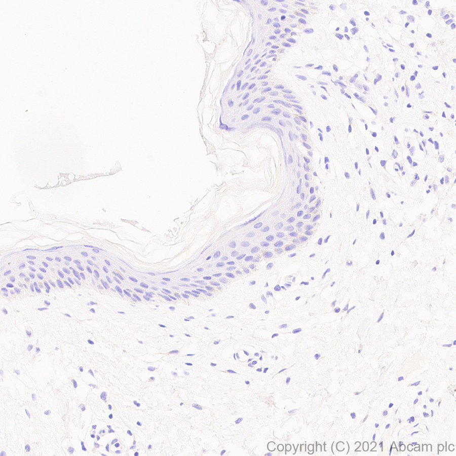 Immunohistochemistry (Formalin/PFA-fixed paraffin-embedded sections) - Anti-IL-15RA antibody [EPR24784-142] (AB273022), expandable thumbnail
