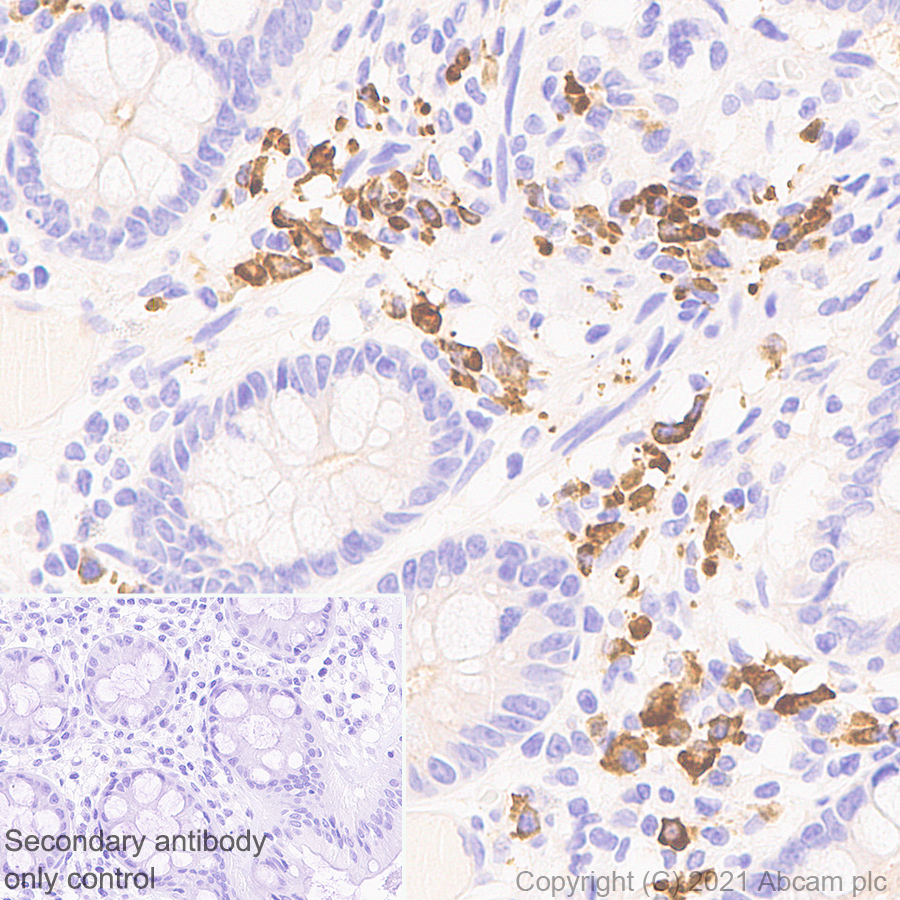 Immunohistochemistry (Formalin/PFA-fixed paraffin-embedded sections) - Anti-IL-15RA antibody [EPR24784-142] (AB273022), expandable thumbnail