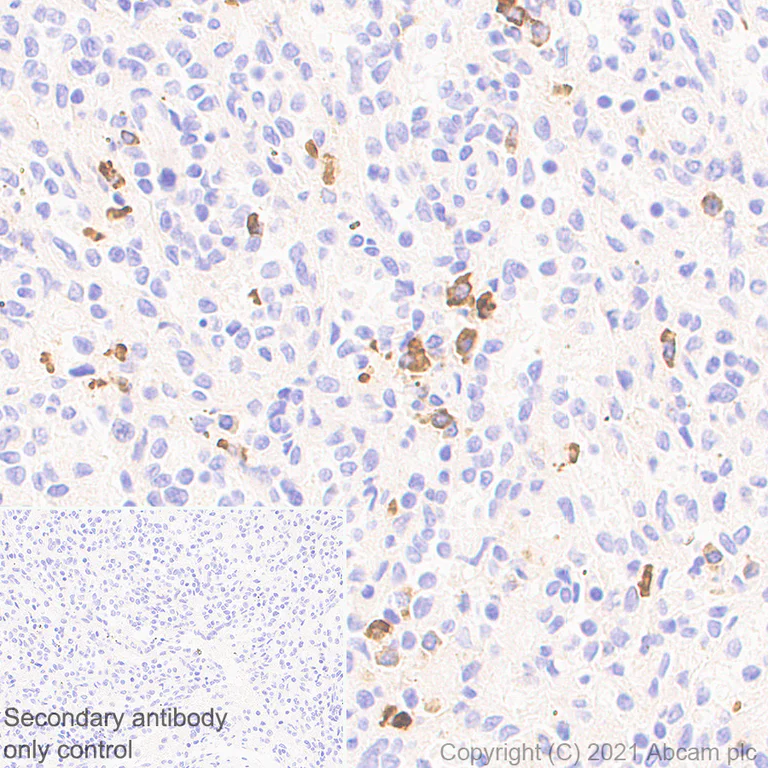 Immunohistochemistry (Formalin/PFA-fixed paraffin-embedded sections) - Anti-IL-15RA antibody [EPR24784-142] - BSA and Azide free (AB282288)