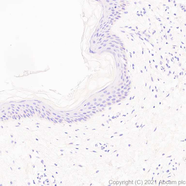 Immunohistochemistry (Formalin/PFA-fixed paraffin-embedded sections) - Anti-IL-15RA antibody [EPR24784-142] - BSA and Azide free (AB282288)
