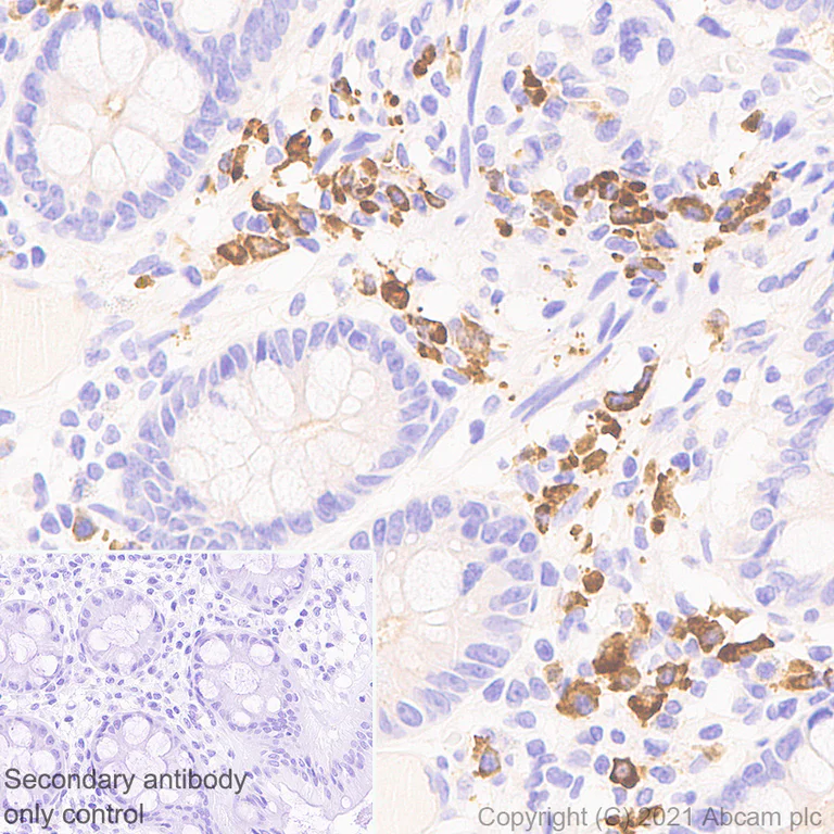 Immunohistochemistry (Formalin/PFA-fixed paraffin-embedded sections) - Anti-IL-15RA antibody [EPR24784-142] - BSA and Azide free (AB282288)