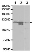 Western blot - Anti-IL-16 antibody (AB180792), expandable thumbnail