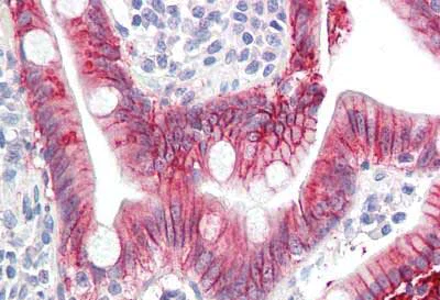 Immunohistochemistry (Formalin/PFA-fixed paraffin-embedded sections) - Anti-IL-17A antibody [4K5F6] (AB189377)