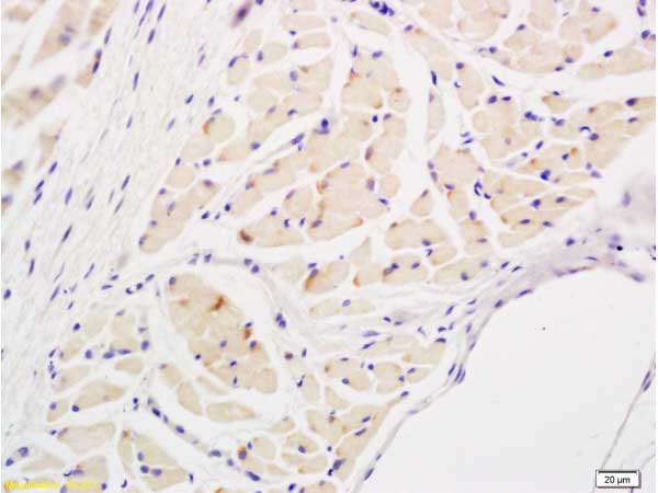 Immunohistochemistry (Formalin/PFA-fixed paraffin-embedded sections) - Anti-IL-17A antibody (AB214588)