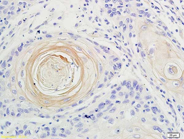 Immunohistochemistry (Formalin/PFA-fixed paraffin-embedded sections) - Anti-IL-17A antibody (AB217359), expandable thumbnail