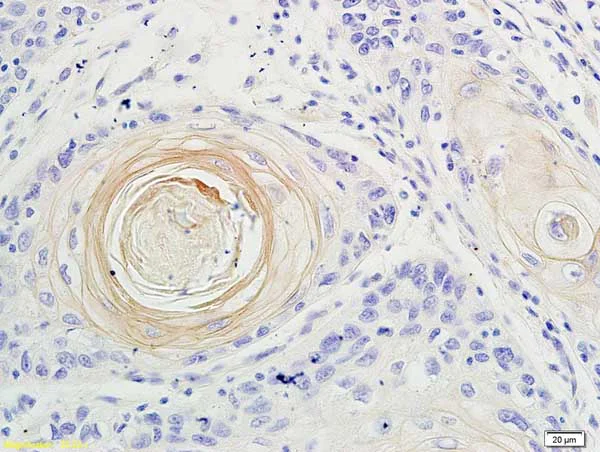Immunohistochemistry (Formalin/PFA-fixed paraffin-embedded sections) - Anti-IL-17A antibody (AB217359)