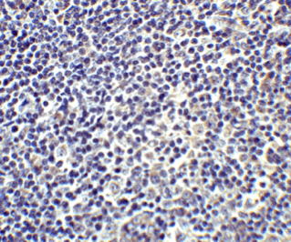 Immunohistochemistry (Formalin/PFA-fixed paraffin-embedded sections) - Anti-IL-17A antibody (AB79056), expandable thumbnail