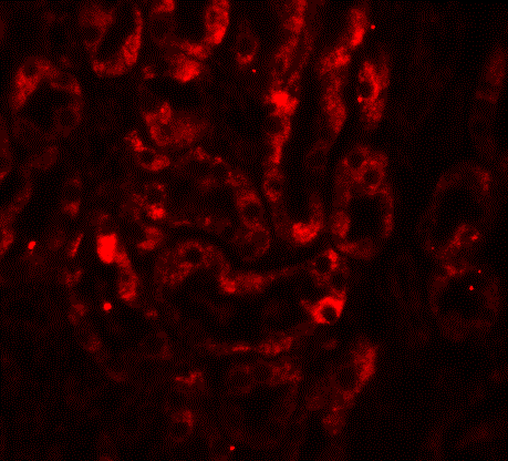 Immunohistochemistry (Formalin/PFA-fixed paraffin-embedded sections) - Anti-IL-17A antibody (AB79056), expandable thumbnail