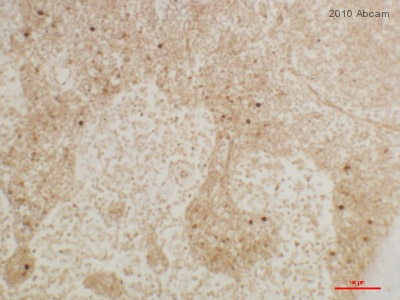 Immunohistochemistry (Formalin/PFA-fixed paraffin-embedded sections) - Anti-IL-17A antibody (AB79056), expandable thumbnail