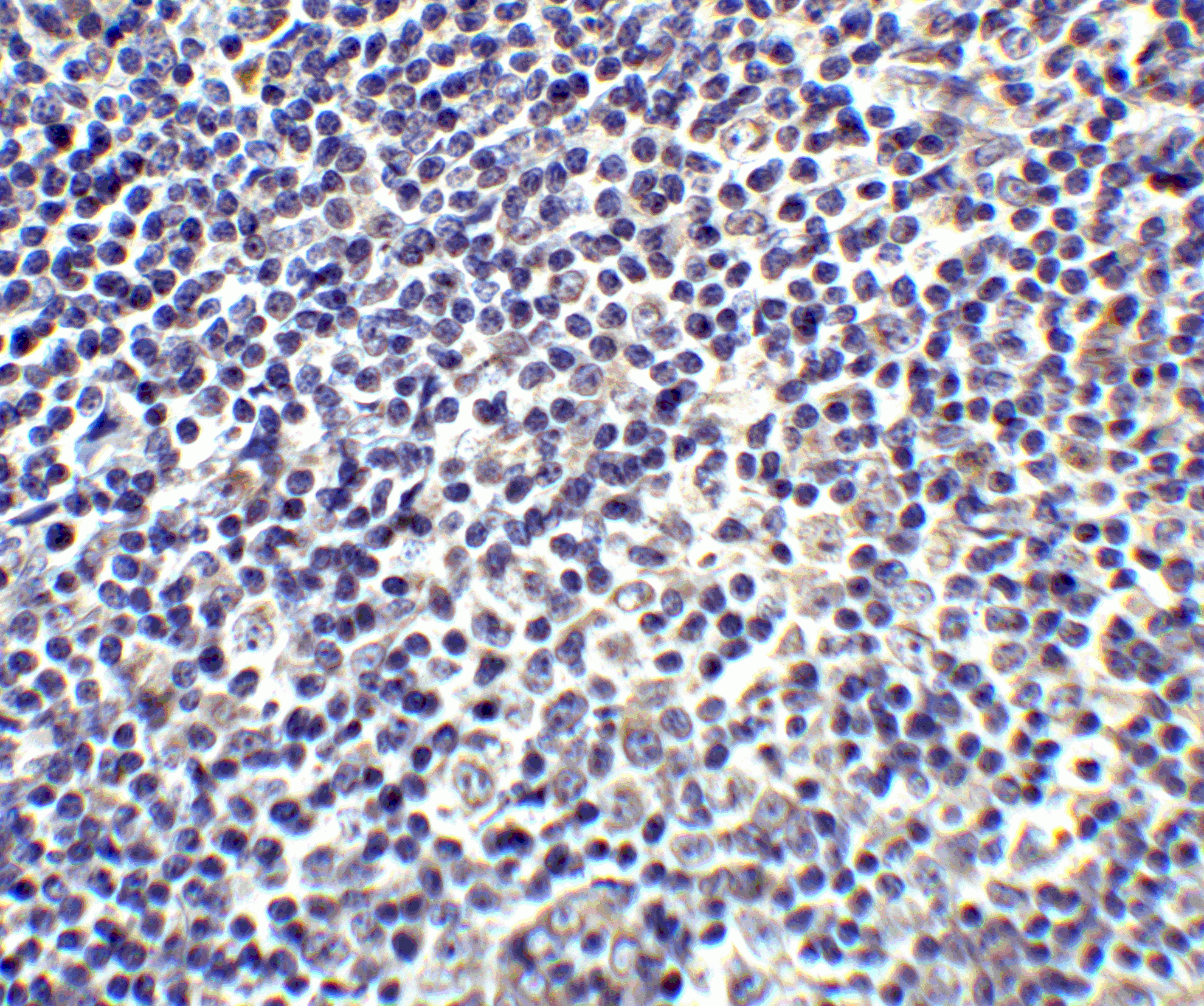 Immunohistochemistry (Formalin/PFA-fixed paraffin-embedded sections) - Anti-IL-17A antibody (AB79056)