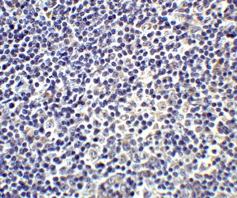 Immunohistochemistry (Formalin/PFA-fixed paraffin-embedded sections) - Anti-IL-17A antibody (AB79056)