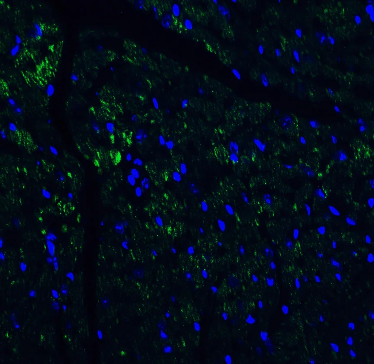Immunohistochemistry (Formalin/PFA-fixed paraffin-embedded sections) - Anti-IL-17A antibody (AB79056)