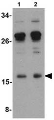 Western blot - Anti-IL-17A antibody (AB79056), expandable thumbnail
