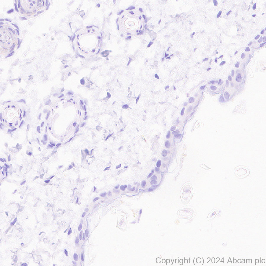 Immunohistochemistry (Formalin/PFA-fixed paraffin-embedded sections) - Anti-IL-17A antibody [RM1202] - BSA and Azide free (ab318151), expandable thumbnail