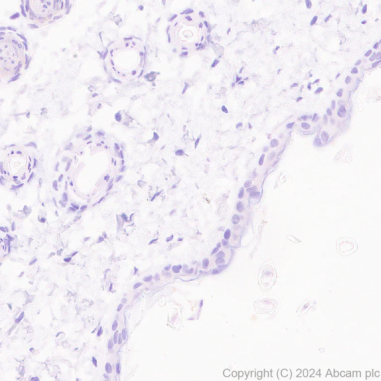 Immunohistochemistry (Formalin/PFA-fixed paraffin-embedded sections) - Anti-IL-17A antibody [RM1202] - BSA and Azide free (AB318151)