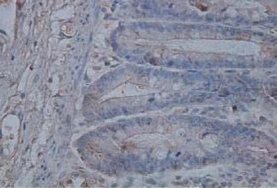 Immunohistochemistry (Formalin/PFA-fixed paraffin-embedded sections) - Anti-IL-17B antibody (AB106272)