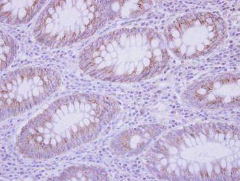 Immunohistochemistry (Formalin/PFA-fixed paraffin-embedded sections) - Anti-IL-17C antibody (AB153896), expandable thumbnail