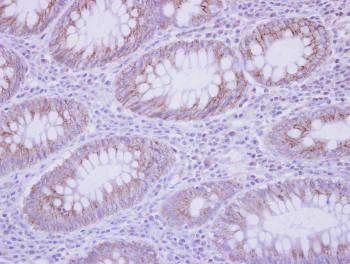Immunohistochemistry (Formalin/PFA-fixed paraffin-embedded sections) - Anti-IL-17C antibody (AB153896)