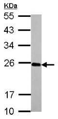 Western blot - Anti-IL-17C antibody (AB153896), expandable thumbnail
