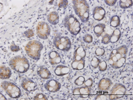 Immunohistochemistry (Formalin/PFA-fixed paraffin-embedded sections) - Anti-IL-17F antibody (AB168194)