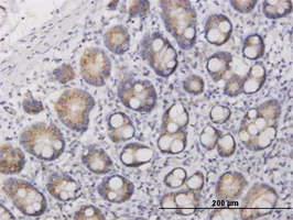 Immunohistochemistry (Formalin/PFA-fixed paraffin-embedded sections) - Anti-IL-17F antibody (AB168194)