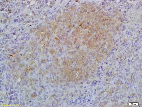 Immunohistochemistry (Formalin/PFA-fixed paraffin-embedded sections) - Anti-IL-17RA antibody (AB218249)