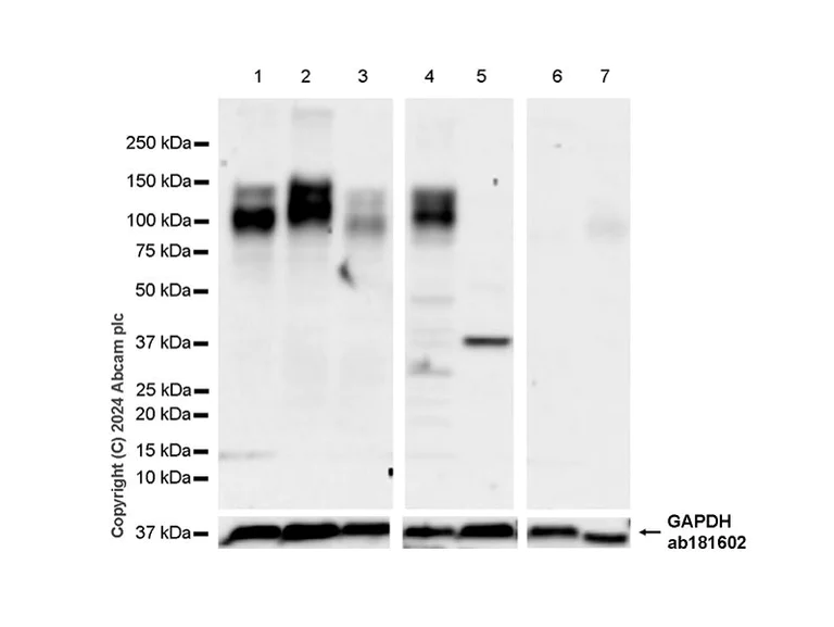 Western blot - Anti-IL-17RA antibody [EPR26126-57] - BSA and Azide free (AB318131)