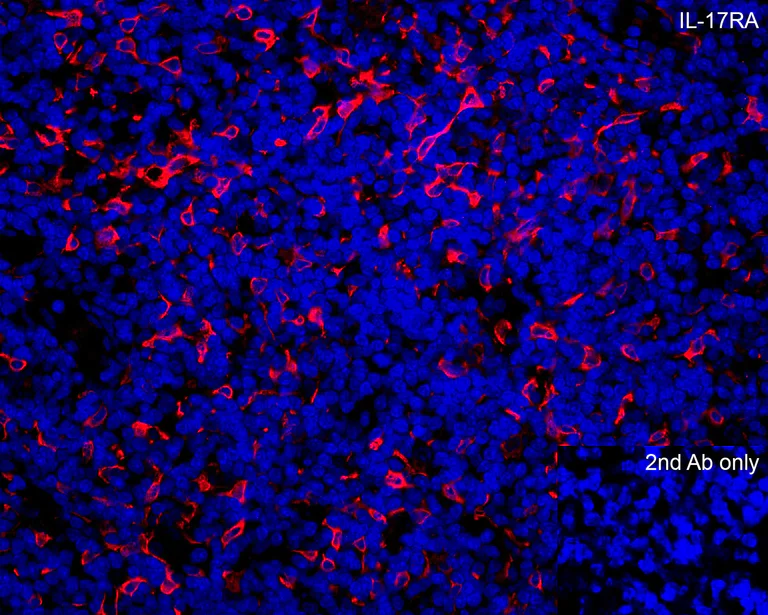 Immunohistochemistry (Formalin/PFA-fixed paraffin-embedded sections) - Anti-IL-17RA antibody - N-terminal (AB180904)