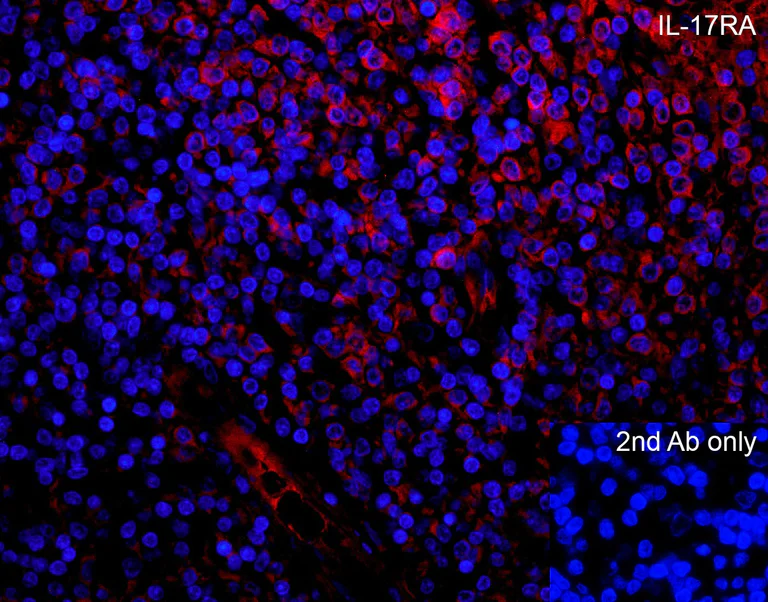 Immunohistochemistry (Formalin/PFA-fixed paraffin-embedded sections) - Anti-IL-17RA antibody - N-terminal (AB180904)