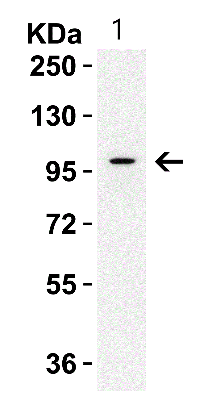 Western blot - Anti-IL-17RA antibody - N-terminal (AB180904)