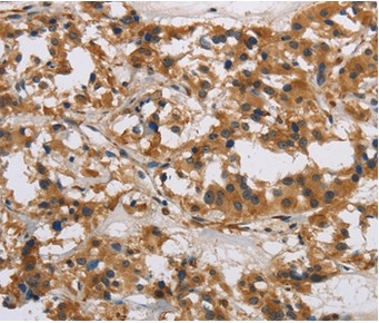 Immunohistochemistry (Formalin/PFA-fixed paraffin-embedded sections) - Anti-IL-17RB antibody (AB198891)